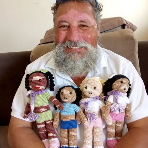  Opa mit Vitiligo stellt Puppen her, die das Selbstwertgefühl stärken